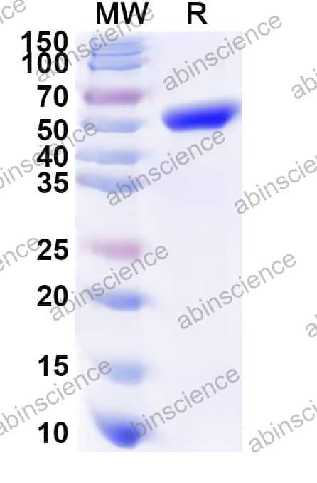 Human PDHA2 Recombinant Protein (N-His)