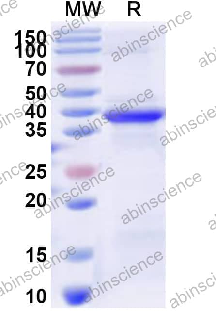 Human HAND2 Recombinant Protein (N-His-KSI)