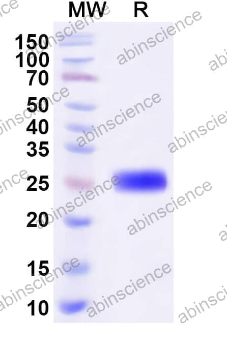 Human SPRR1B Recombinant Protein (N-His-KSI)