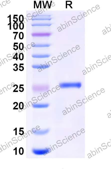 Human RHOBTB1 Recombinant Protein (N-His)