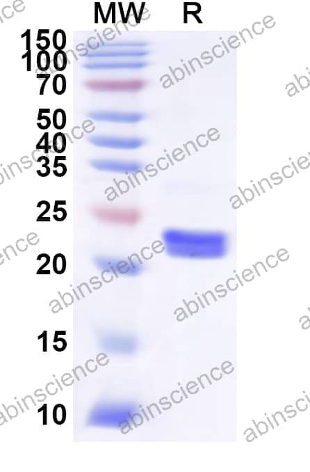 Human PMVK Recombinant Protein (N-His)