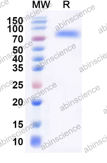 Human CPT2 Recombinant Protein (N-His)