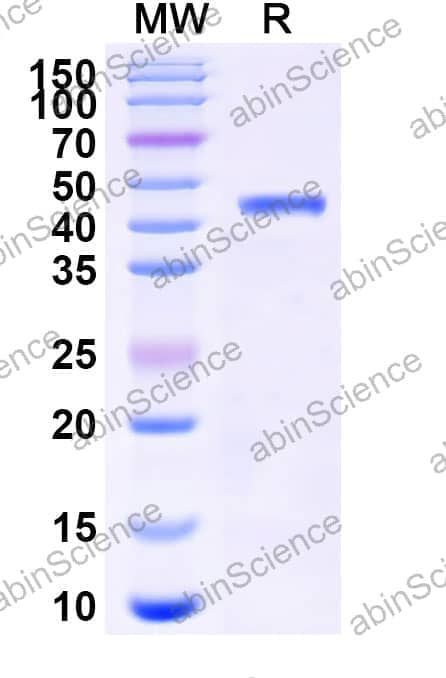 Human NT5C1A/cN1A Recombinant Protein (C-His)