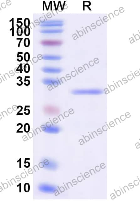 Human EI24 Recombinant Protein (N-His-KSI)