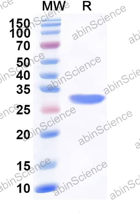 Human FKBP8 Recombinant Protein (N-His)