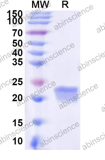 Human GM2A Recombinant Protein (N-His)