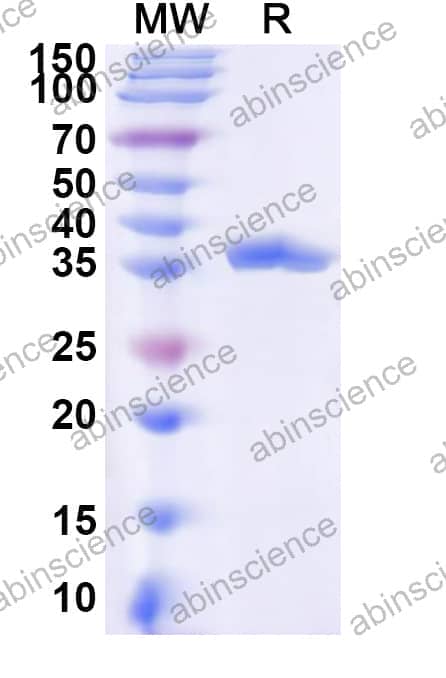 Human SLC6A9 Recombinant Protein (N-GST & C-His)