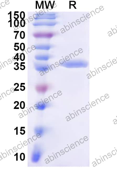 Human SLC6A5 Recombinant Protein (N-GST & C-His)