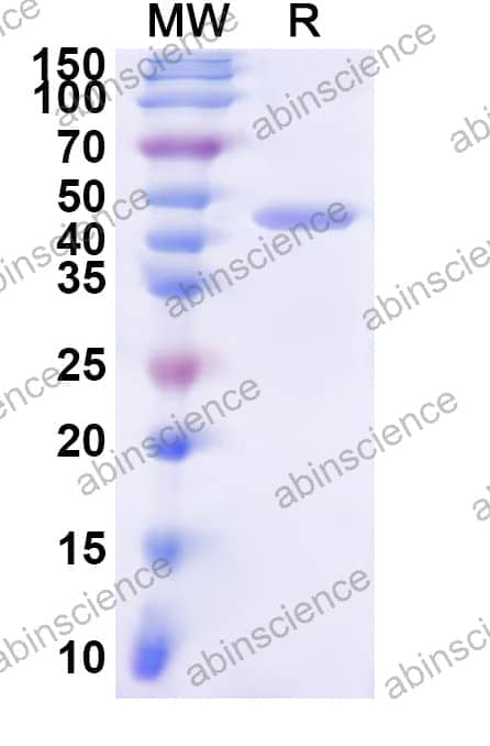 Human PMS2 Recombinant Protein (N-His)