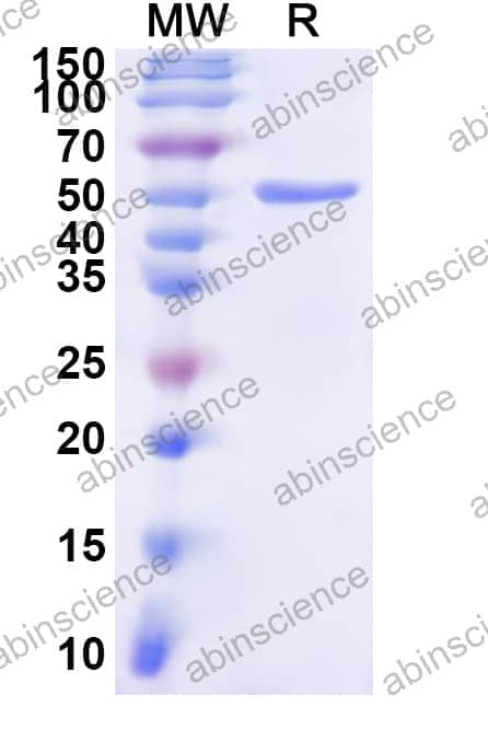 Human UGT1A6 Recombinant Protein (N-His)