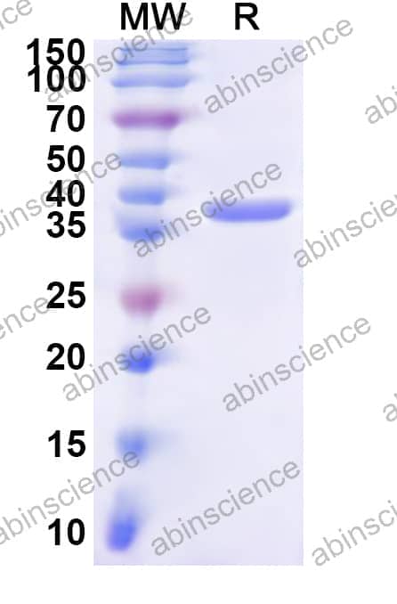 Human POLR2C Recombinant Protein (N-His)