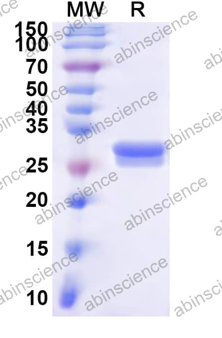 Human POLR2E Recombinant Protein (N-His)