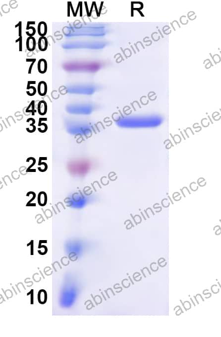 Human MSH3 Recombinant Protein (N-His)