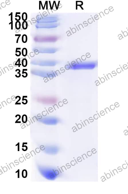 Human GNAZ Recombinant Protein (N-His)