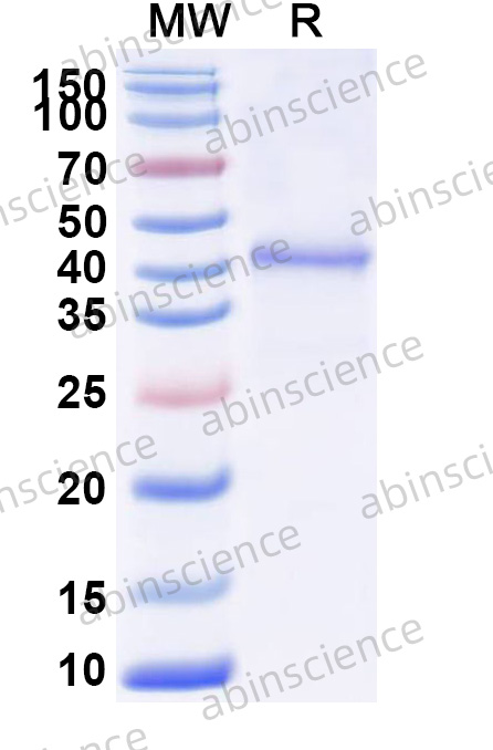 Human GNAT2 Recombinant Protein (N-His)