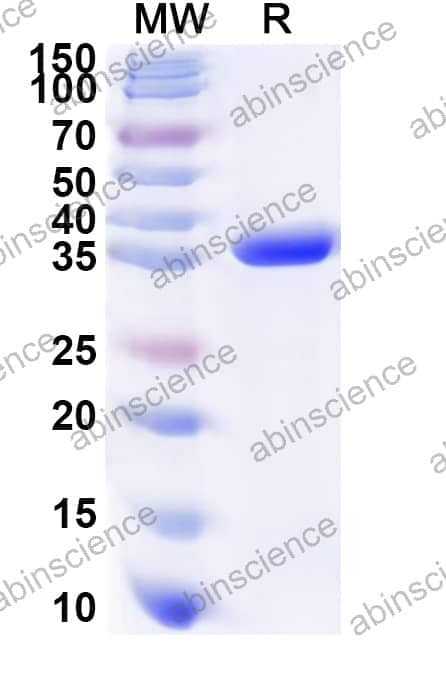 Human SDS Recombinant Protein (N-His)
