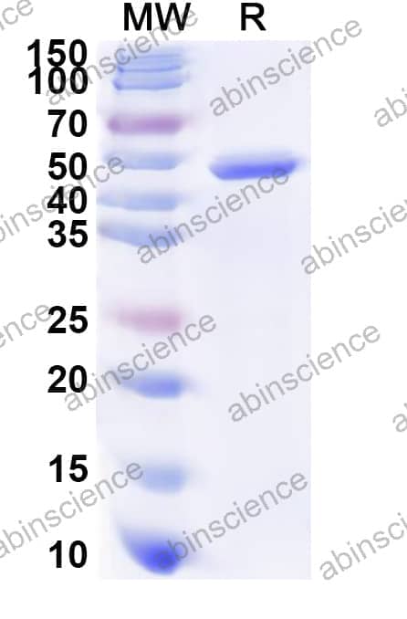 Human UGT1A1 Recombinant Protein (N-His)