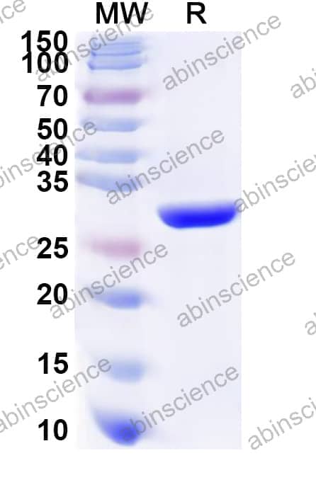 Human COL9A1 Recombinant Protein (N-His)
