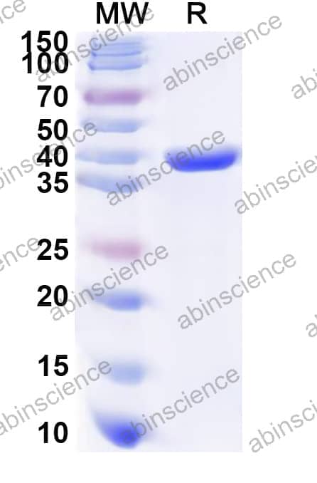 Human BCKDHB Recombinant Protein (N-His)