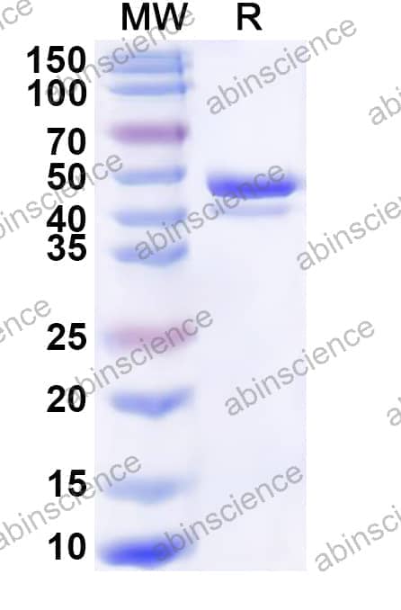 Human DDX6 Recombinant Protein (N-His)