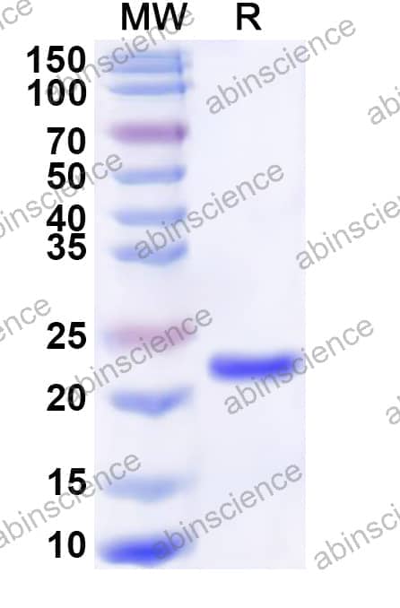 Human CRYGS Recombinant Protein (N-His)
