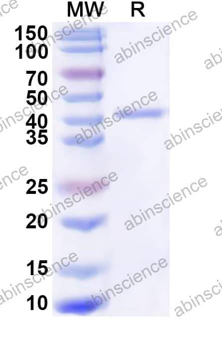 Human ADH6 Recombinant Protein (N-His)