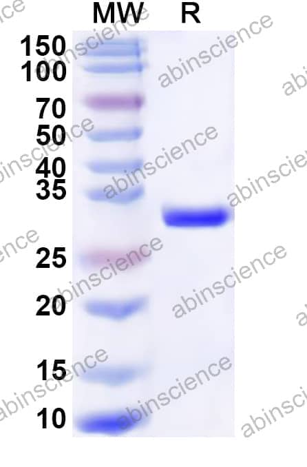 Human EVI2A Recombinant Protein (N-His-KSI)