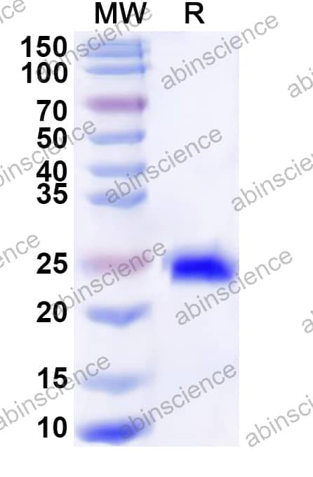 Human XPA Recombinant Protein (N-His)