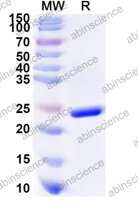 Human GTF2E2 Recombinant Protein (N-His)