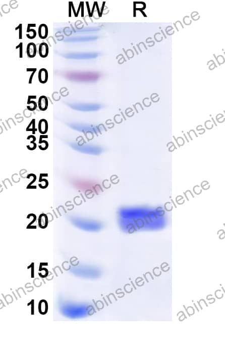 Human RPL12 Recombinant Protein (N-His)