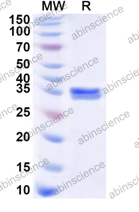 Human PBLD Recombinant Protein (N-His)