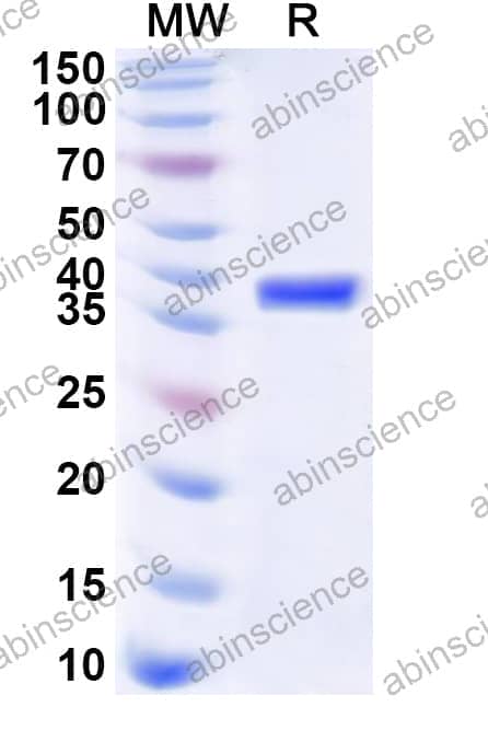 Human PRKAR2B Recombinant Protein (N-His)