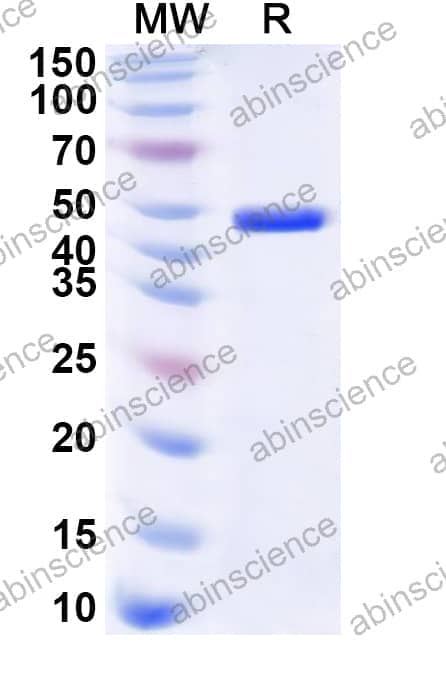 Human POLR2B Recombinant Protein (N-His)