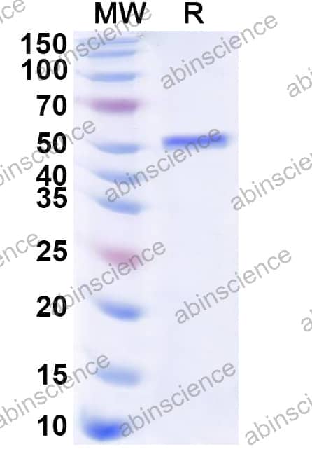 Human HOXC9 Recombinant Protein (N-His-KSI)