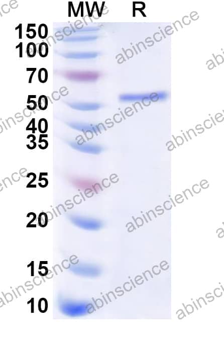Human HOXC13 Recombinant Protein (N-His-KSI)