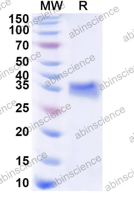 Human SPRR2A Recombinant Protein (N-His-KSI)