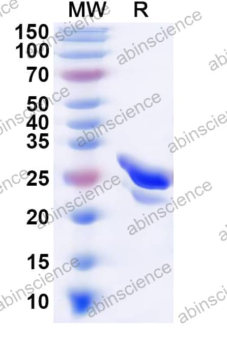 Human GTF2F1 Recombinant Protein (N-His)