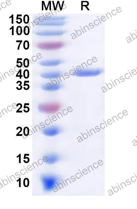 Human GNAL Recombinant Protein (N-His)