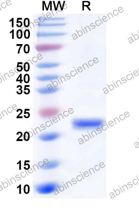 Human PSMB10 Recombinant Protein (N-His)