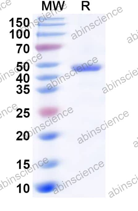 Human ADH7 Recombinant Protein (N-His)