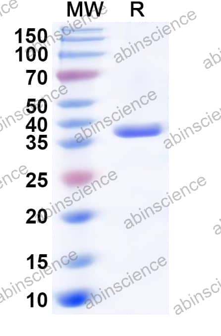 Human PTPN7 Recombinant Protein (N-His)