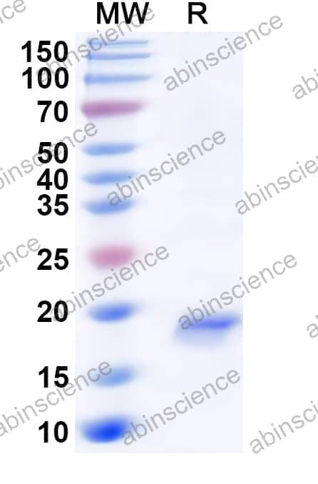 Human PLA2G5 Recombinant Protein (N-His)