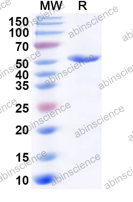 Human IGHMBP2 Recombinant Protein (N-His)