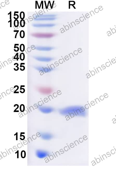 Human BUD31 Recombinant Protein (N-His)