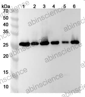 Anti-NAA10 Polyclonal Antibody