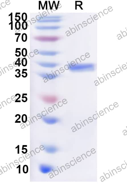 Human VIPR2 Recombinant Protein (N-GST & C-His)
