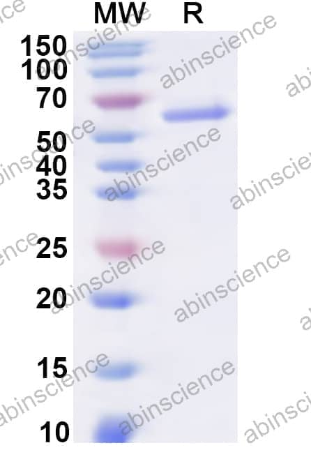 Human EIF2S3 Recombinant Protein (N-His)