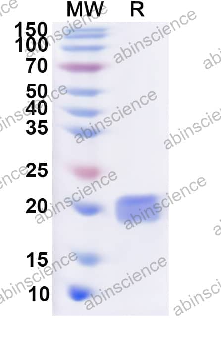 Human MLLT3 Recombinant Protein (N-His)