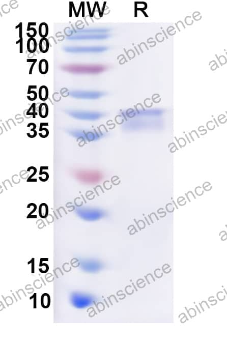 Human MAP3K8 Recombinant Protein (N-His)