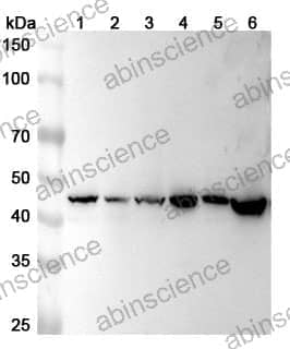 Anti-ACTR1B Polyclonal Antibody